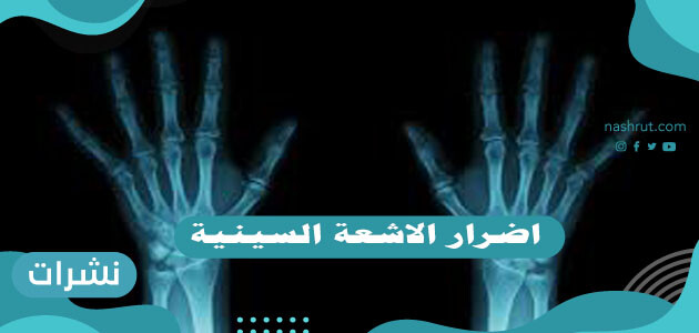 اضرار الاشعة السينية