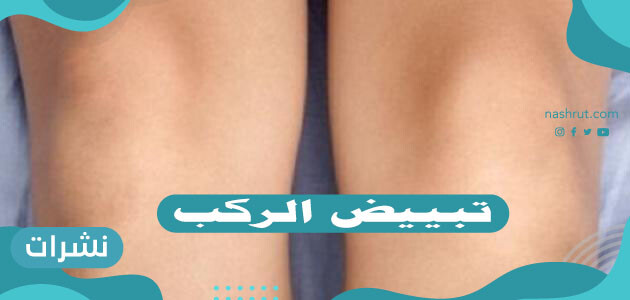كيفية تبييض الركب