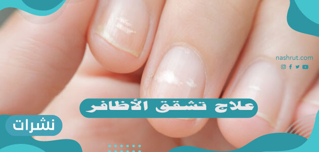 علاج تشقق الأظافر
