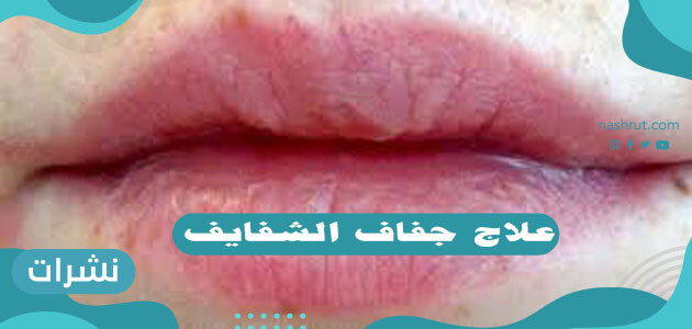 علاج جفاف الشفايف