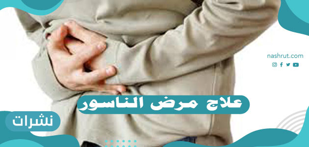 علاج مرض الناسور