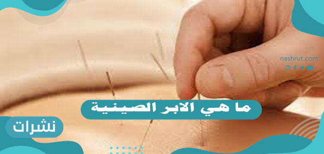 ما هي الابر الصينية