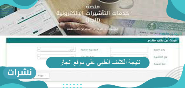 نتيجة الكشف الطبى على موقع انجاز