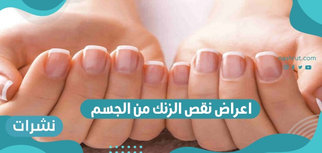 اعراض نقص الزنك من الجسم