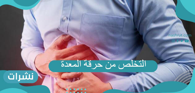 التخلص من حرقة المعدة بسرعة