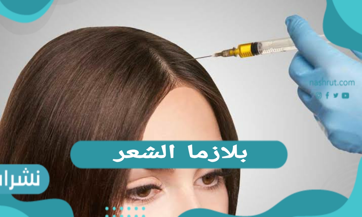 بلازما الشعر… الفوائد والأضرار ونصائح ما بعد الحقن