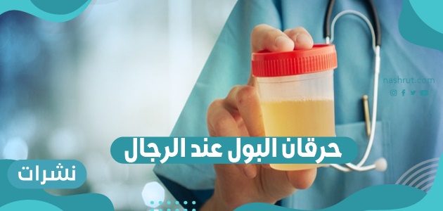 حرقان البول عند الرجال
