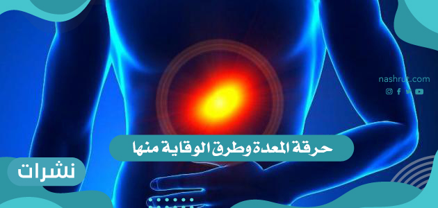 حرقة المعدة وطرق الوقاية منها