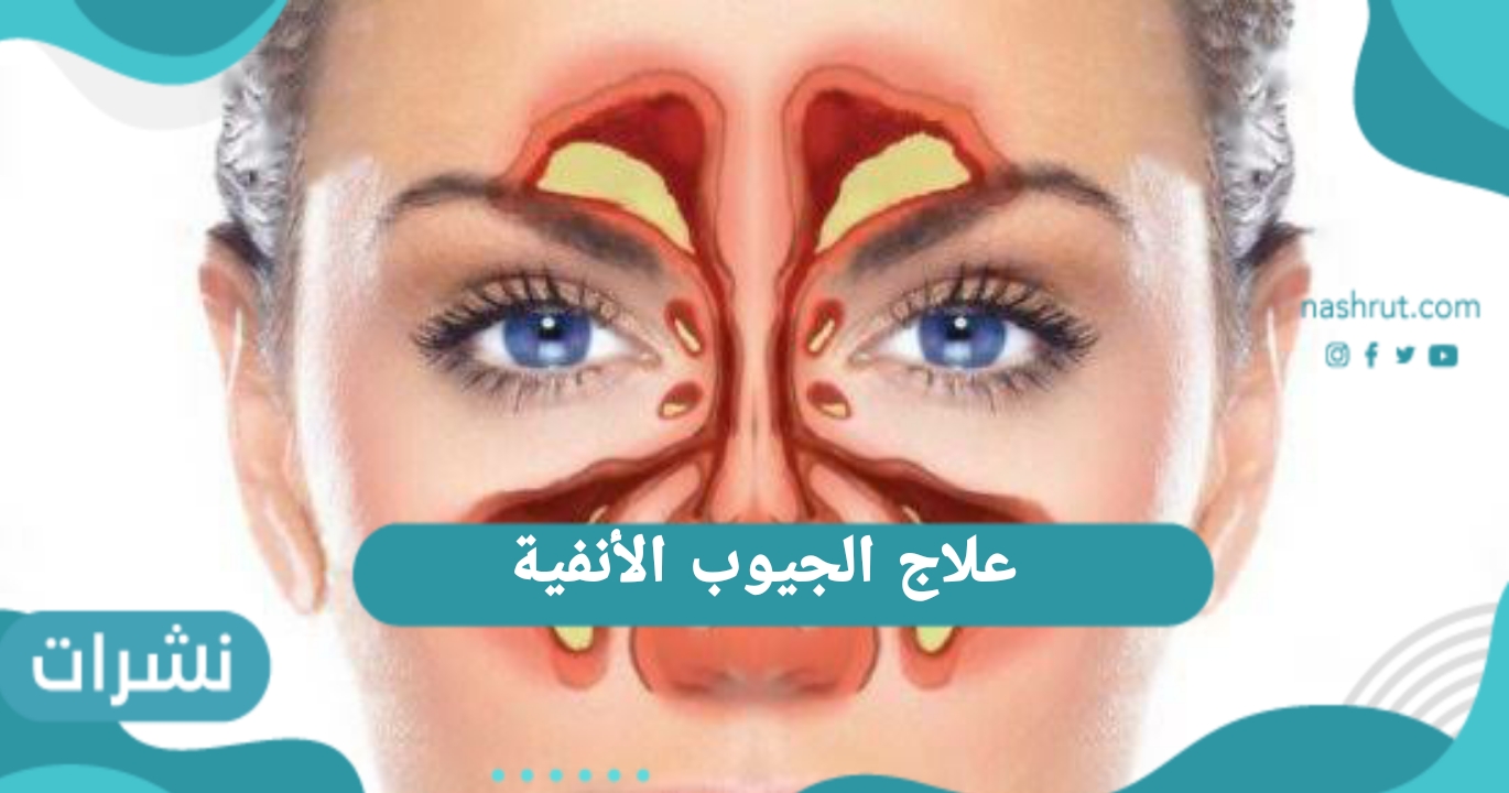 علاج الجيوب الأنفية 