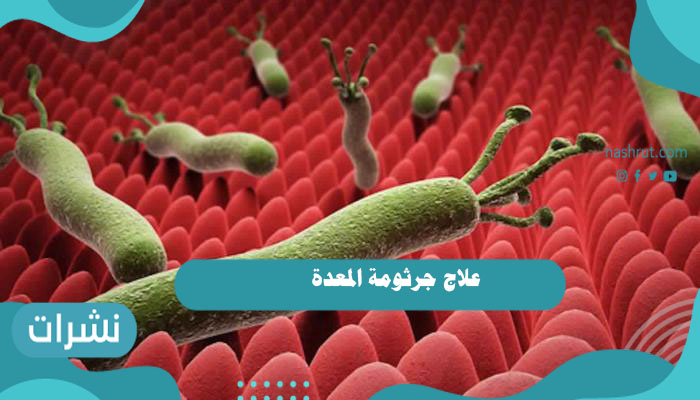 علاج جرثومة المعدة بالأدوية وبالأعشاب الطبيعية