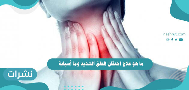 ما هو علاج احتقان الحلق الشديد وما أسبابة