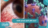 أسباب الفطر الأسود وأعراض الإصابة
