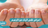 اعراض نقص الزنك من الجسم