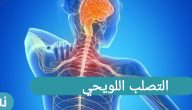 التصلب اللويحي متى يظهر وما هي أعراضه؟