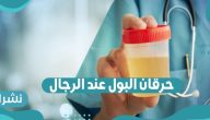 حرقان البول عند الرجال