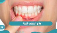 علاج التهاب اللثة .. أهم الأعراض والمسببات وطرق الوقاية