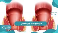 علاج الشرخ المزمن جابر القحطاني