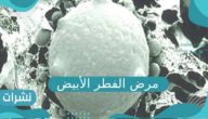 مرض الفطر الأبيض.. ماهي أبرز أعراضه وسبب ظهوره وهل تحول لوباء؟