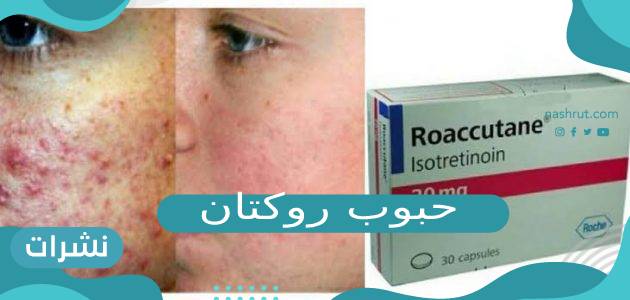 حبوب روكتان دواعي الاستخدام والآثار الجانبية لها