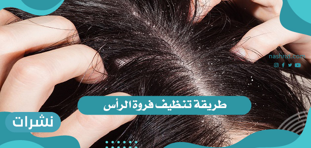 طريقة تنظيف فروة الرأس بـ 3 طرق مجربة