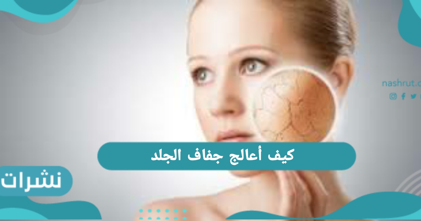 كيف أعالج جفاف الجلد