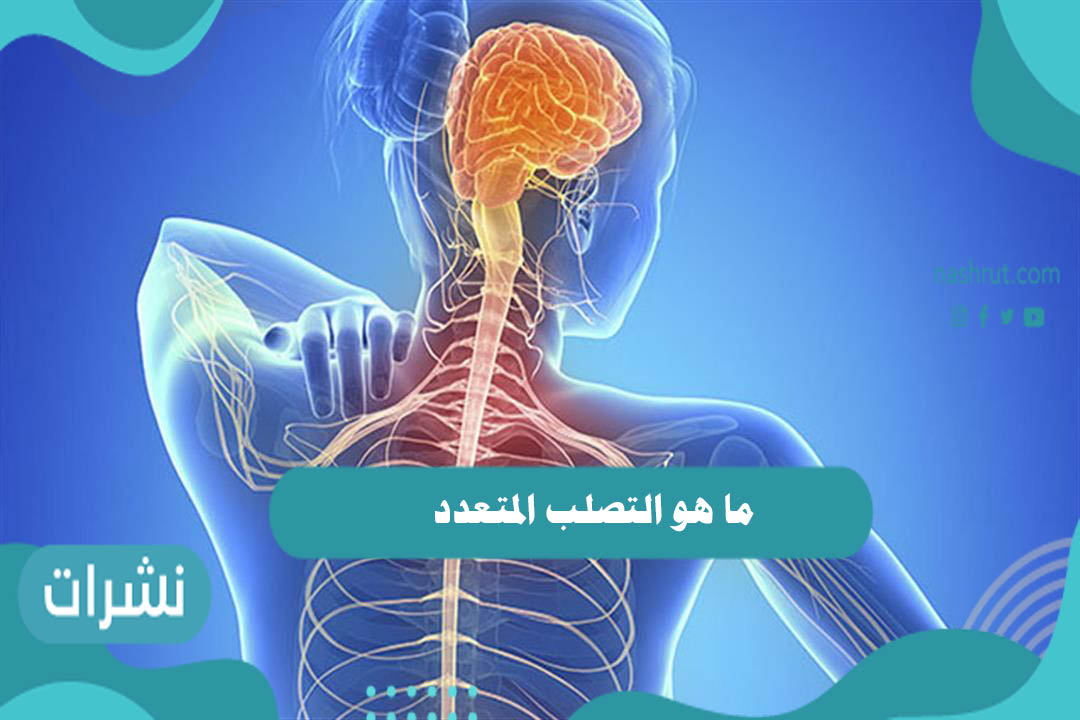 ما هو التصلب المتعدد