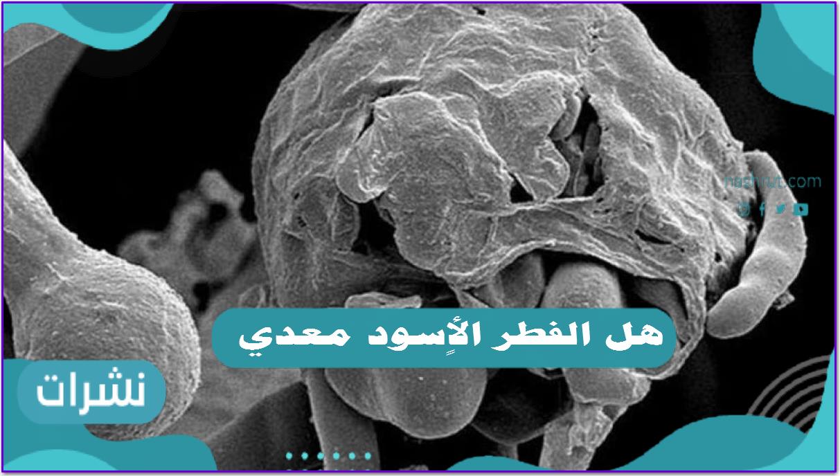 هل الفطر الأسود معدي؟ وسبب انتشاره بكثره في الفترة الأخيرة