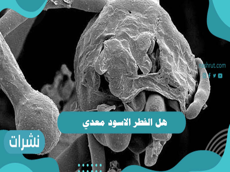 هل الفطر الاسود معدي؟ وكيف تنتقل العدوى