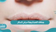 جفاف الفم ومرض السكر