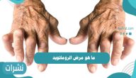 ما هو مرض الروماتويد وأسبابه وأعراضه وكيفية علاجه