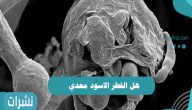 هل الفطر الاسود معدي؟ وكيف تنتقل العدوى