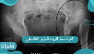 كم نسبة الروماتيزم الطبيعي في جسم الإنسان
