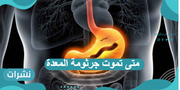 متى تموت جرثومة المعدة وماهي طرق علاجها الطبيعية ؟
