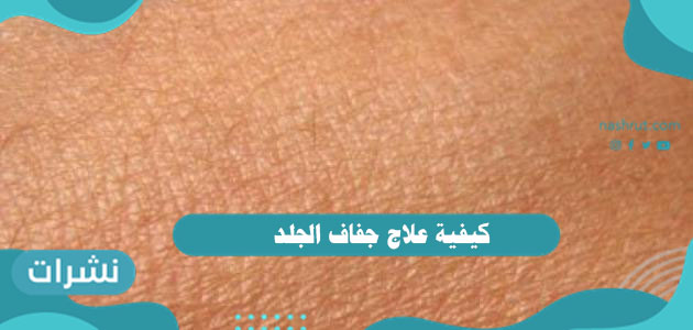 كيفية علاج جفاف الجلد بالتفصيل