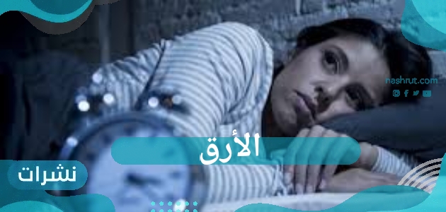الأرق