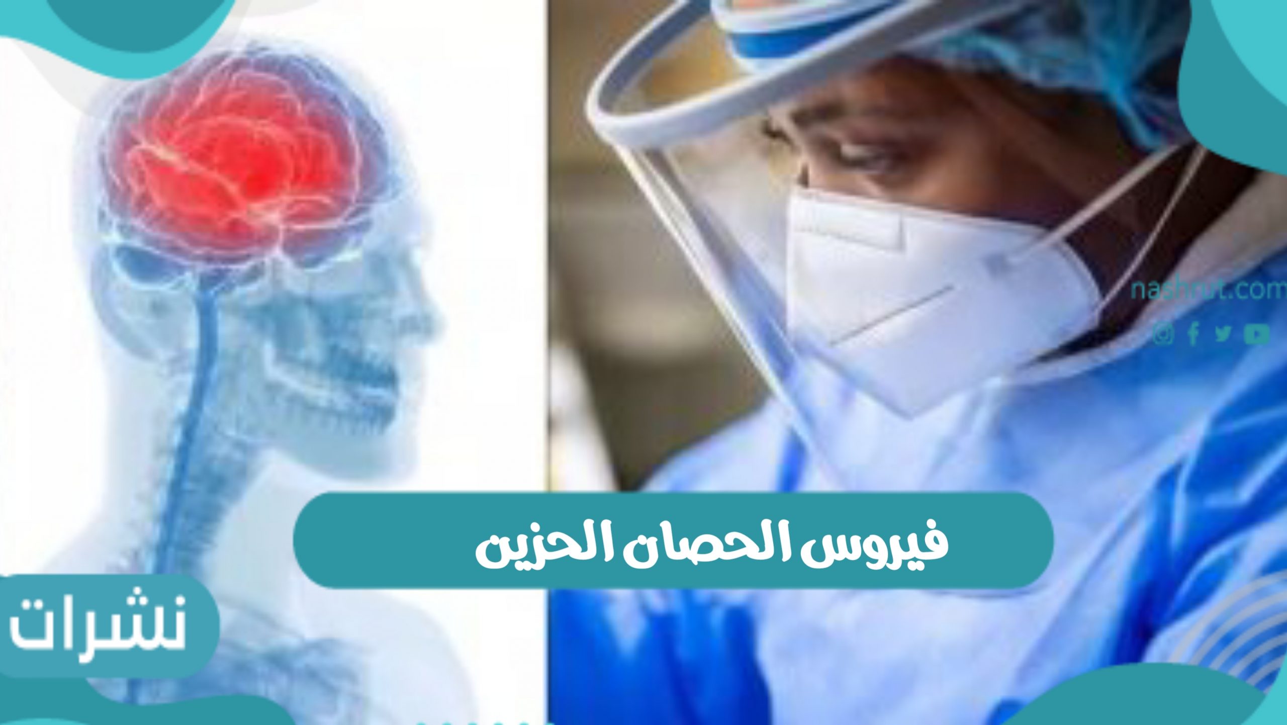 اعراض فيروس الحصان الحزين وطرق العلاج