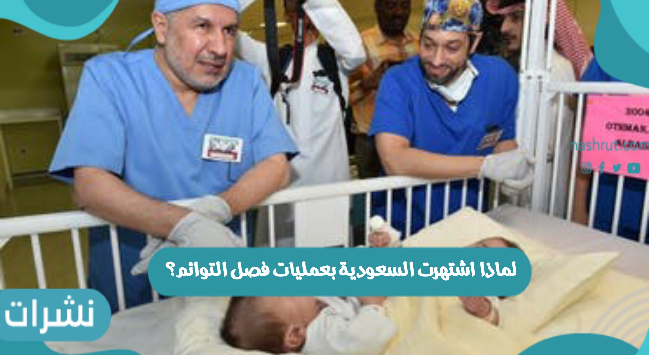 لماذا اشتهرت السعودية بعمليات فصل التوائم؟
